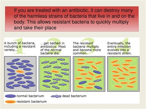 Remove the bacteria infection from .